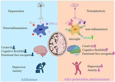 Psilocybin for the treatment of Alzheimer’s disease